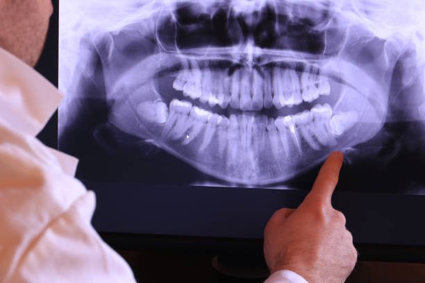 Best Mobile Emergency Dentist in Forreston, IL