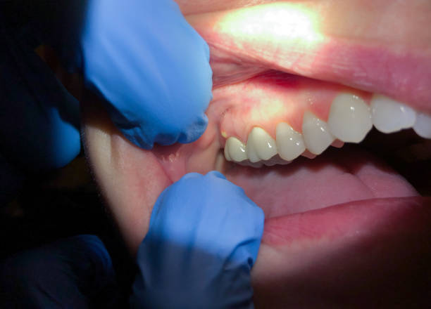 Best Emergency Cosmetic Dentistry in Forreston, IL