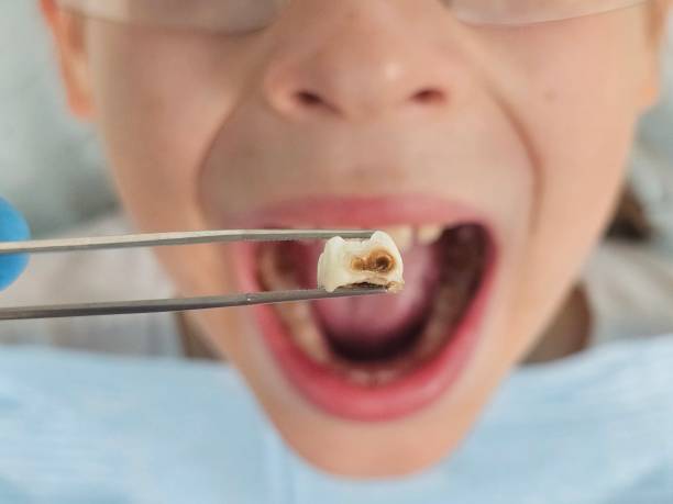 Best 24-Hour Emergency Dentist in Forreston, IL