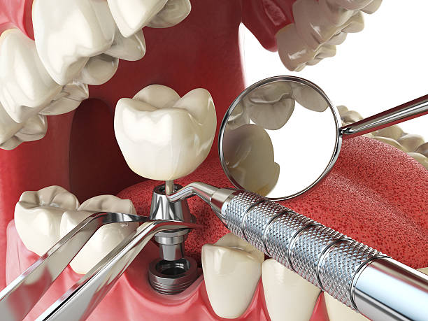 Best Weekend Emergency Dentist in Forreston, IL